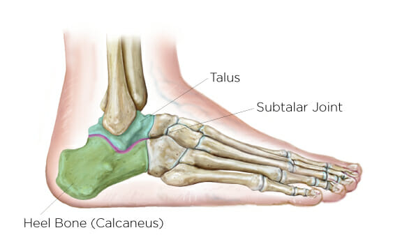 Ankle Surgery  Summit Orthopedics