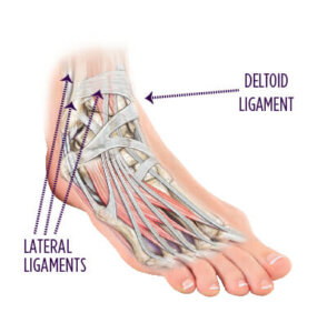 Ankle Sprains | Summit Orthopedics