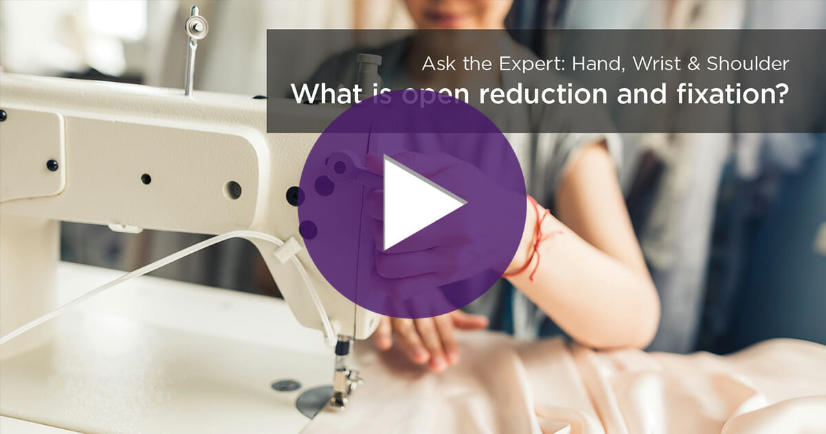 what-is-open-reduction-and-fixation-video-summit-orthopedics